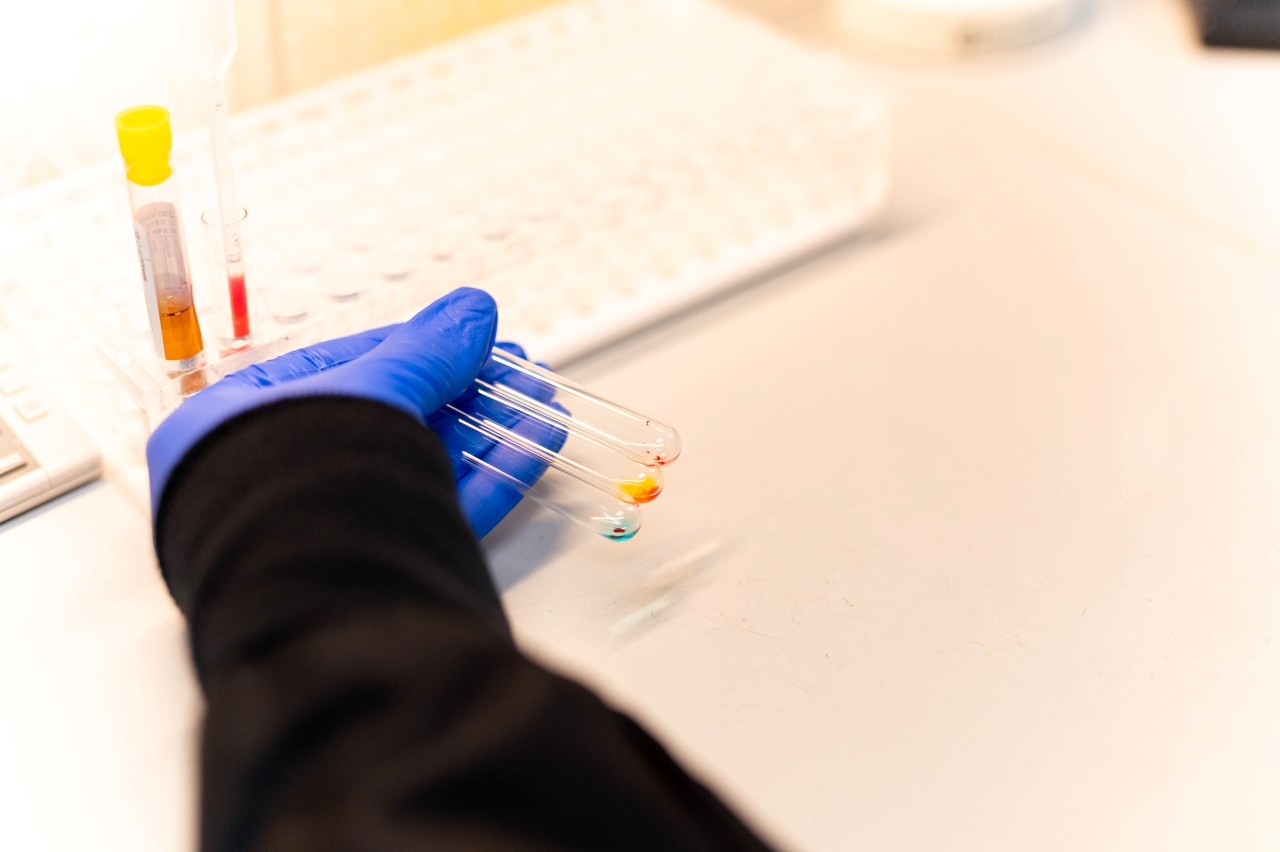 Lab specialist holds vials. 