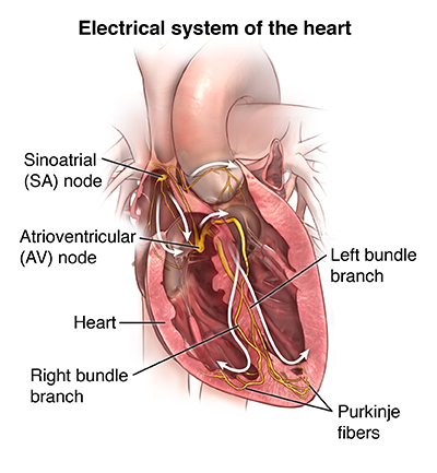 Electrical Systems of the Heart - Ventricular Arrythmias