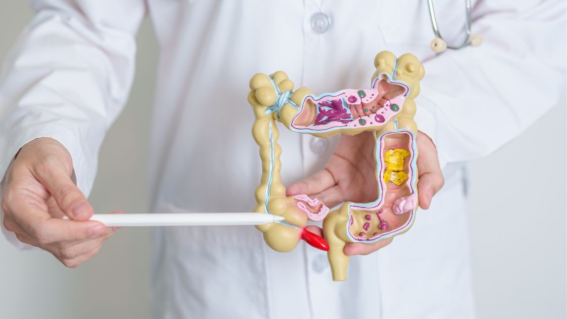 Inflammatory Bowel Disease (IBD)