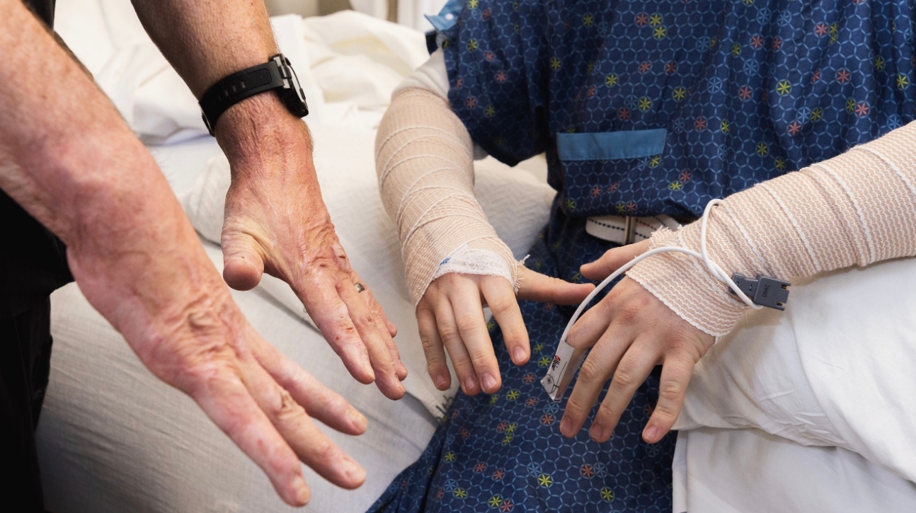 Burn Patient doing PT with Burn Survivor.