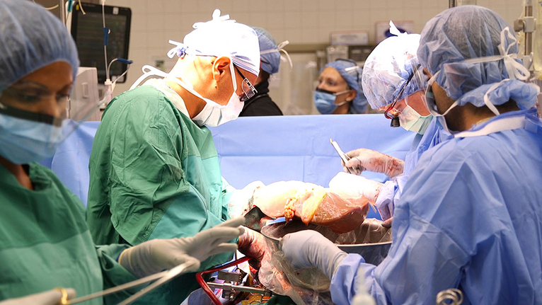 Liver Transplantation in Process