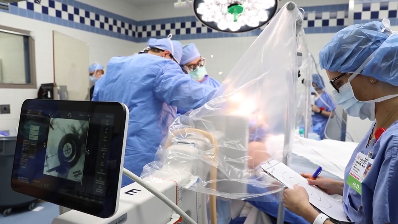 Deep Brain Stimulation Procedure - 2