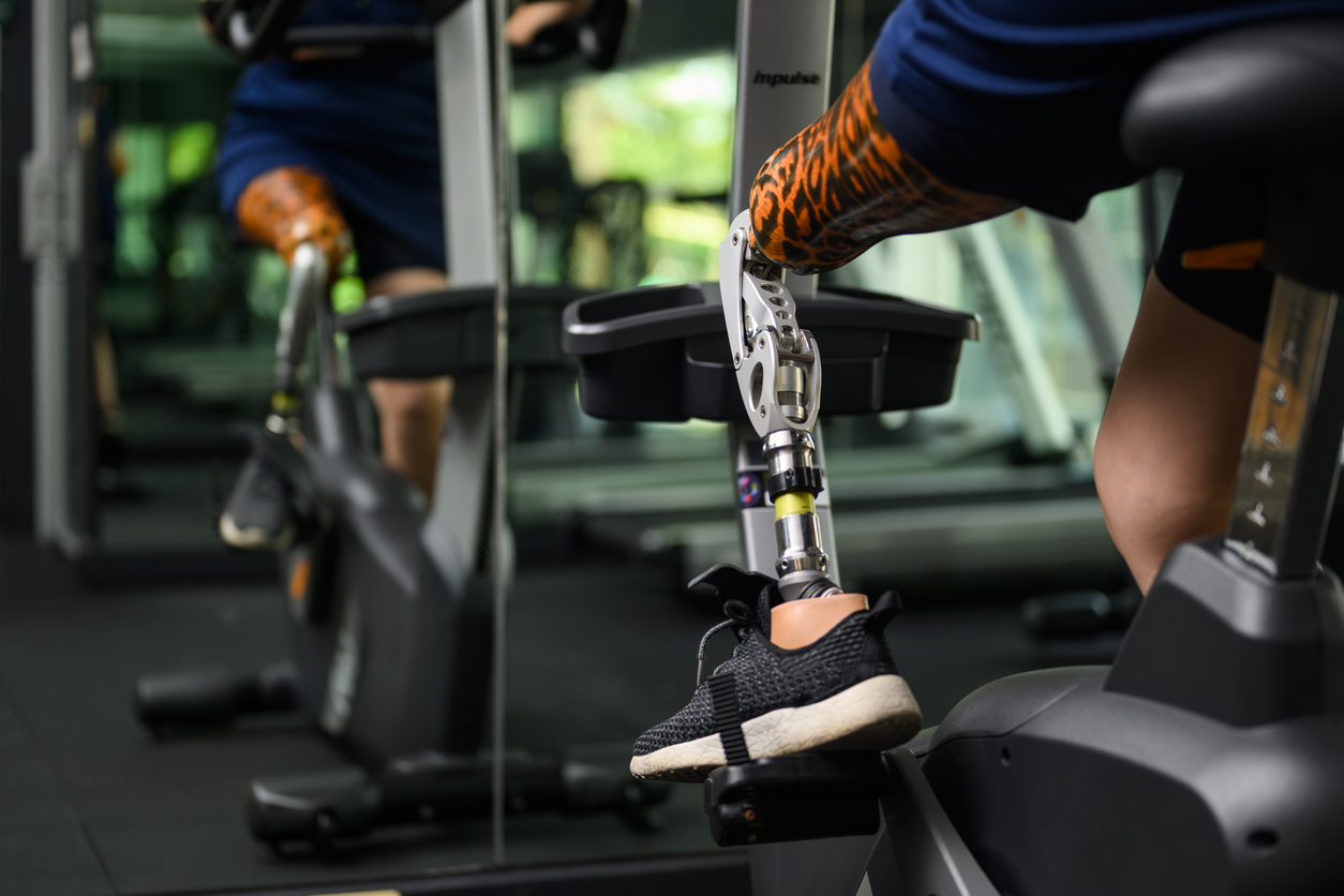 Close up of a prosthetic leg as a biker exercises on a stationary bike 