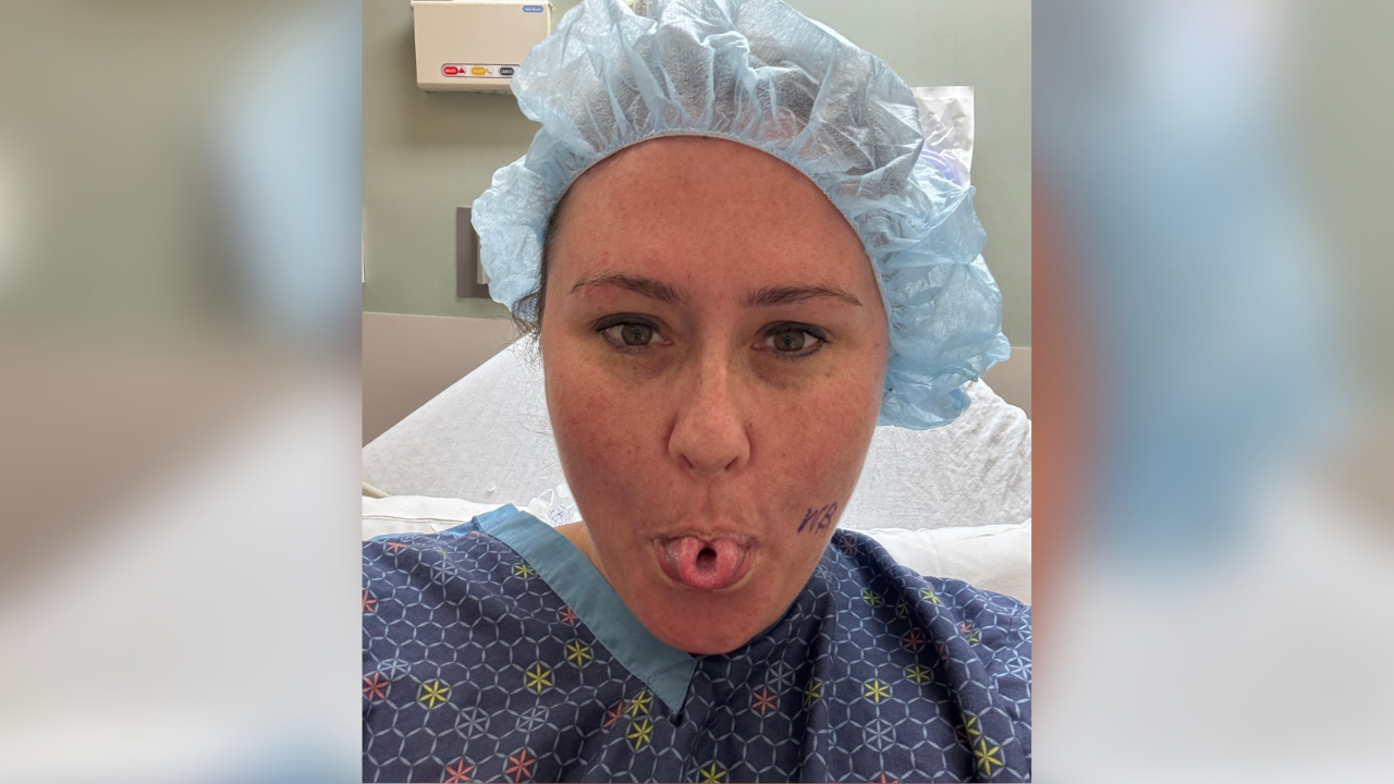 Jenny Hammond shows off her tounge before her surgery to remove adenoid cystic carcinoma. 