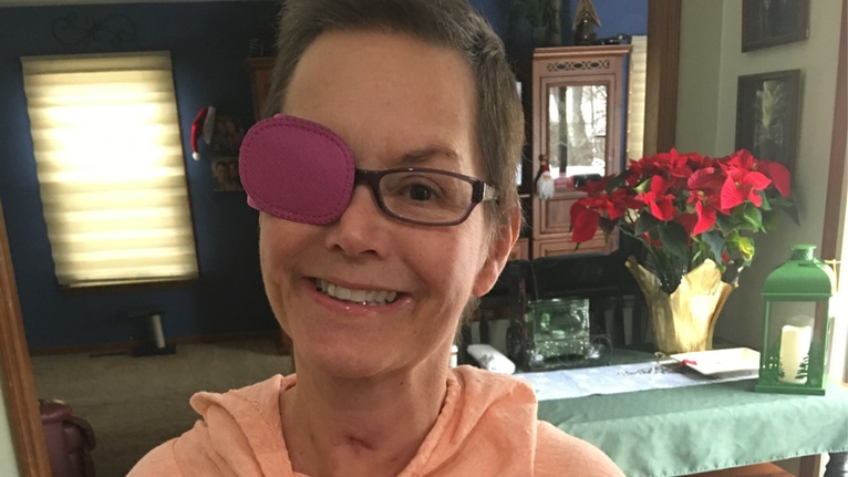 Stephanie's Story: Stroke Recovery with Physical Therapy