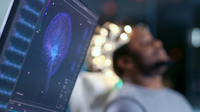 Patient lying on a bed in a lab environment with a computer monitor in the foreground.