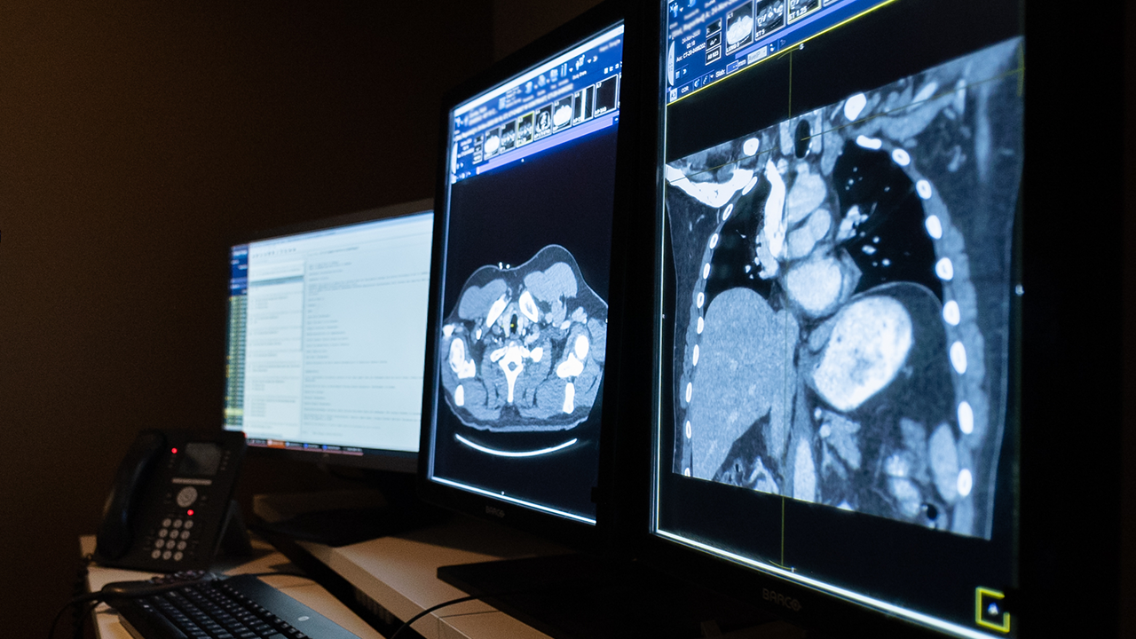 UCMC placenta ultrasound