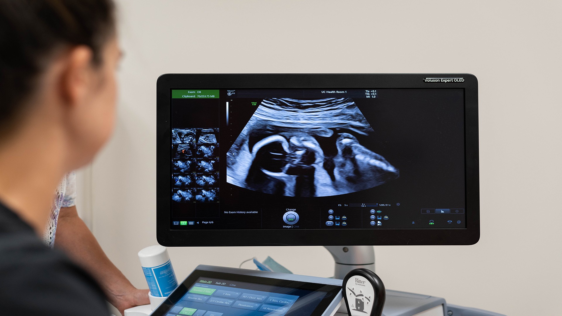 OBGYN placenta radiology image