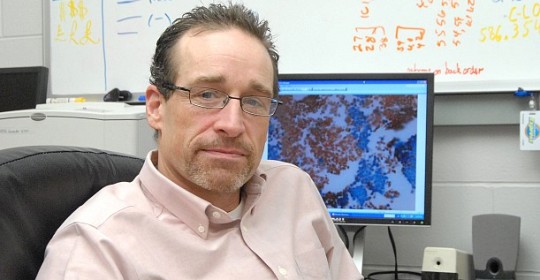 BPA Exposure Affects Heart Health of Males and Females Differently in Mice