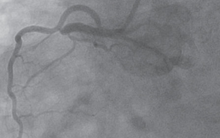 Optimal Management of Patients Surviving an Out of Hospital Cardiac Arrest