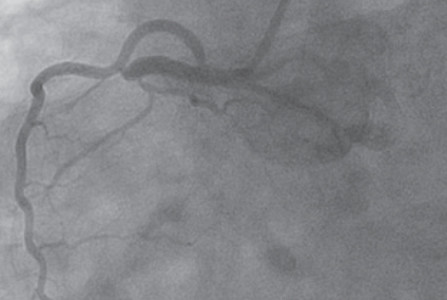 Optimal Management of Patients Surviving an Out of Hospital Cardiac Arrest