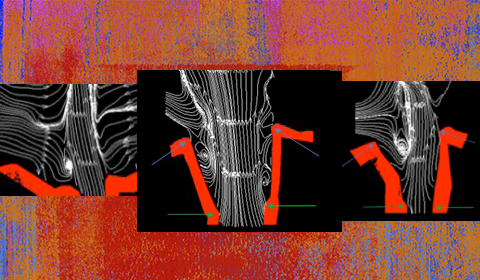 Noted Laryngologist Teams with Aerospace Engineer to Study Vortices, Acoustics, and Vibration in Vocal Fold Asymmetry