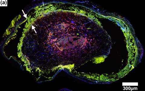 Exploring a Novel Method for Improving Facial Nerve Healing from Facial Nerve Injury