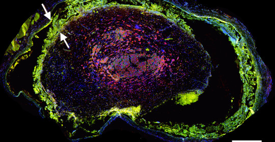 Exploring a Novel Method for Improving Facial Nerve Healing from Facial Nerve Injury