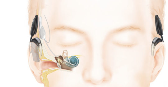 Technological Advances and Research Continue to Transform Hearing Outcomes