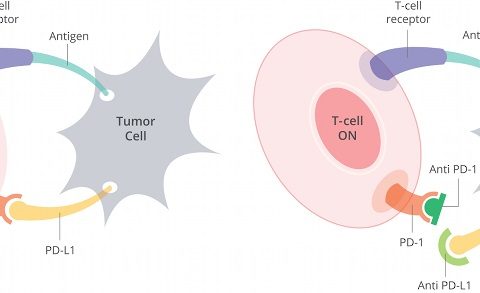 New Phase II Clinical Trial Tests Immunotherapy as Part of Standard Head and Neck Cancer Treatment