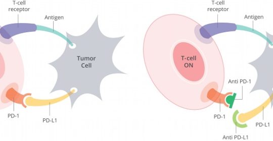 New Phase II Clinical Trial Tests Immunotherapy as Part of Standard Head and Neck Cancer Treatment