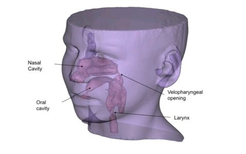 Experimental Modeling to Clarify Speech Disorders Due to VPI