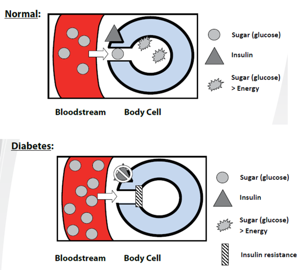 diabetes illus.